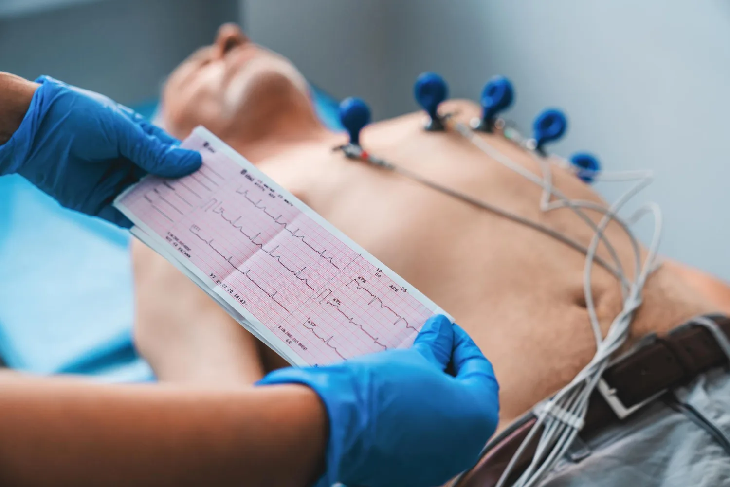 Ecocardiograma transtorácico